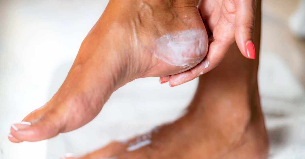 Application de crème anti-frottement sur le pied d’un coureur pour prévenir ampoules et irritations en trail running