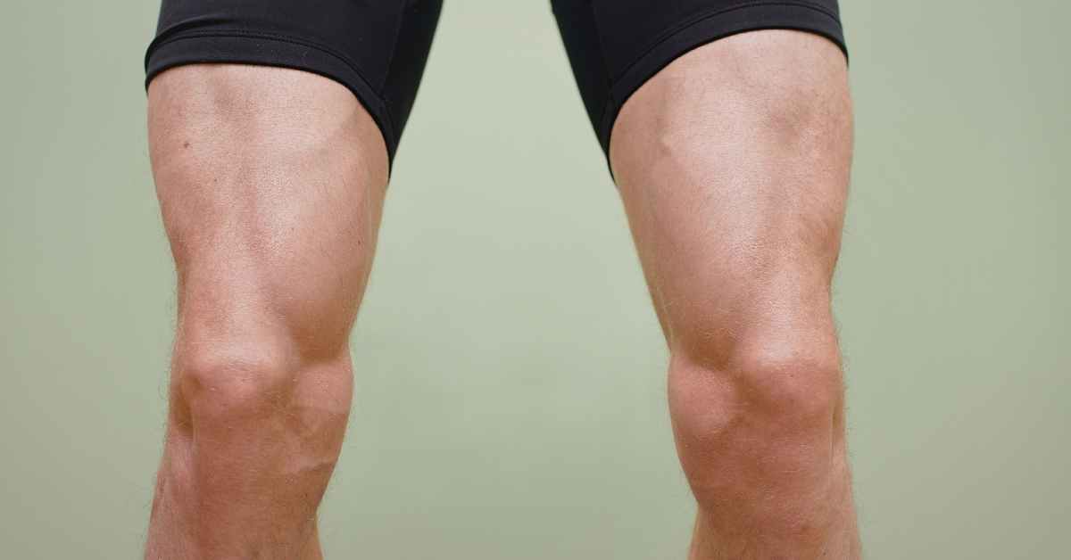 Jambes lourdes après running : causes et solutions efficaces